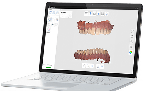 Escáner intraoral Medit - Tecnología dental moderna