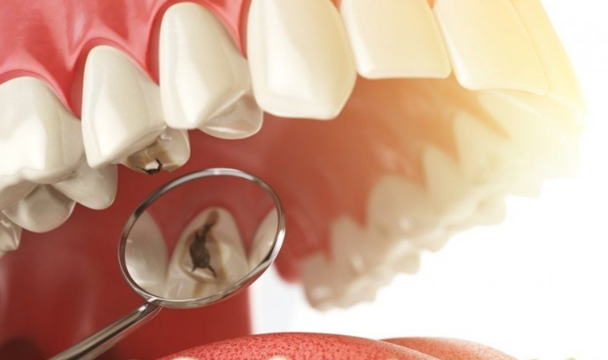 Odontología Conservadora